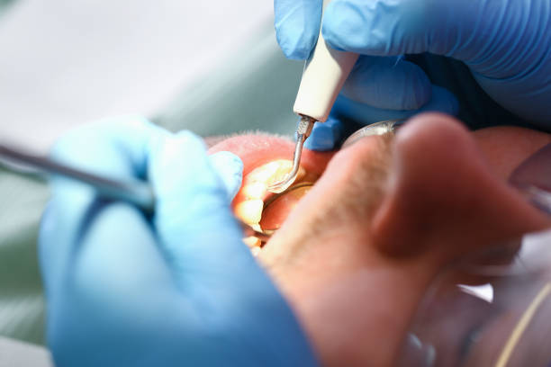 Best Mobile Emergency Dentist in Gardena, CA